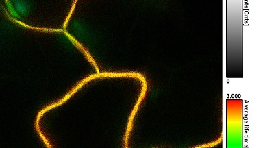 細胞影像平臺激光共聚焦顯微鏡及熒光壽命成像（FV1200-FLIM）上機培訓通知