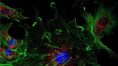 共享儀器平臺超高分辨激光共聚焦顯微鏡Zeiss LSM880上機培訓通知