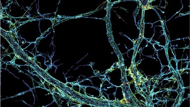 細胞影像平臺圖像處理-反卷積及共定位專題培訓通知