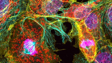 細胞影像平臺Zeiss LSM980 Airyscan2快速超分辨激光共聚焦顯微鏡培訓通知