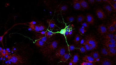 共享儀器平臺超高分辨激光共聚焦顯微鏡Zeiss LSM880上機培訓通知