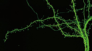 細胞影像平臺轉盤共聚焦顯微鏡上機培訓通知