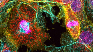 細胞影像平臺Zeiss LSM980 Airyscan2快速超分辨激光共聚焦顯微鏡培訓通知
