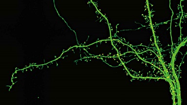 尼康生物影像中心超分辨激光掃描共聚焦顯微鏡上機培訓通知