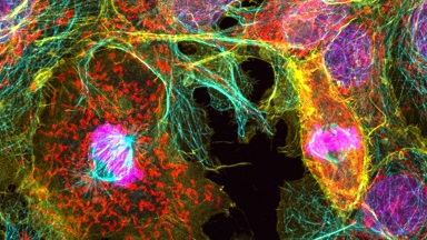 細胞影像平臺Zeiss LSM980 Airyscan2快速超分辨激光共聚焦顯微鏡培訓通知