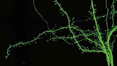 尼康生物影像中心超分辨激光掃描共聚焦顯微鏡上機培訓通知
