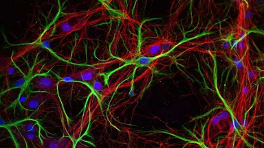 共享儀器平臺超高分辨Zeiss LSM880共聚焦顯微鏡上機培訓通知