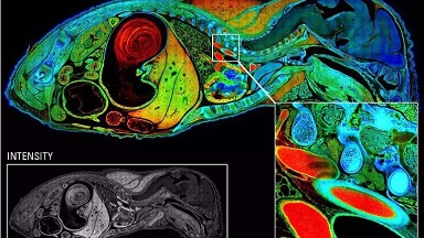 細胞生物學平臺Leica超高分辨激光共聚焦顯微鏡系列（二）培訓通知