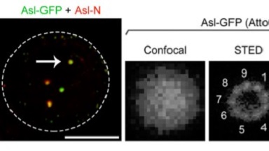 細胞生物學平臺Leica超高分辨激光共聚焦顯微鏡系列（三）培訓通知