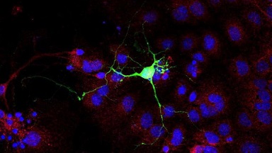 共享儀器平臺超高分辨Zeiss LSM880共聚焦顯微鏡上機培訓通知