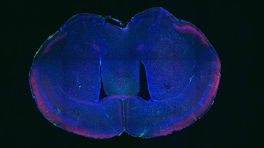 細胞影像平臺轉盤共聚焦顯微鏡上機培訓通知