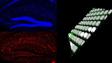 細胞生物學平臺Leica SP8激光共聚焦顯微鏡上機培訓通知