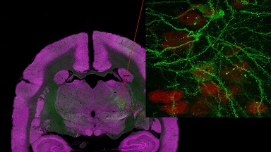 細胞影像平臺Nikon A1R HD25高分辨激光掃描共聚焦顯微鏡培訓通知