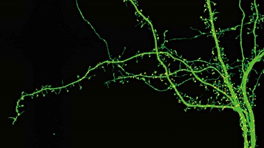 尼康生物影像中心超分辨激光掃描共聚焦顯微鏡上機培訓通知