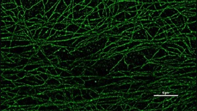 細胞影像平臺超分辨共聚焦顯微鏡培訓通知