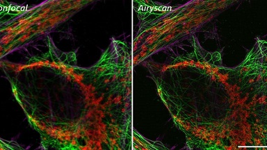 共享儀器平臺Zeiss超高分辨共聚焦顯微鏡LSM880 Airyscan上機培訓