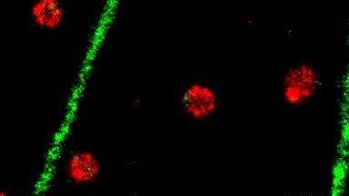 尼康生物影像中心超分辨激光掃描共聚焦顯微鏡高級應用線上培訓通知
