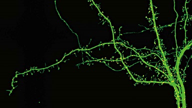 尼康生物影像中心超分辨激光掃描共聚焦顯微鏡上機培訓通知