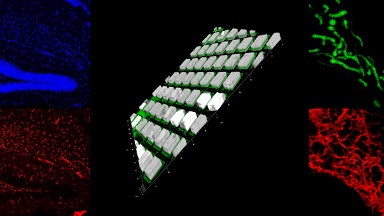 細胞生物學平臺Leica SP8激光共聚焦顯微鏡線上培訓通知