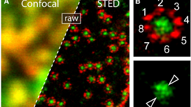 細胞生物學平臺受激發射損耗超高分辨顯微鏡線上培訓通知