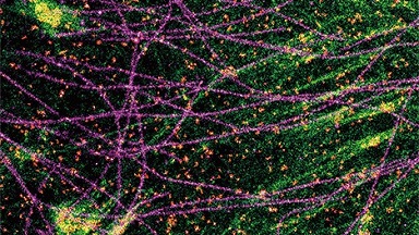 細胞影像平臺超分辨共聚焦顯微鏡線上培訓通知