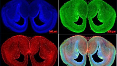 細胞生物學平臺Zeiss全自動數字玻片掃描系統上機培訓通知