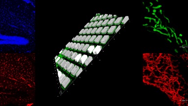 細胞生物學平臺Leica SP8激光共聚焦顯微鏡上機培訓通知