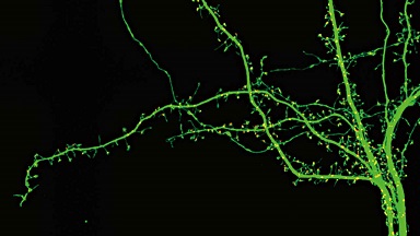 尼康生物影像中心超分辨激光掃描共聚焦顯微鏡上機培訓通知