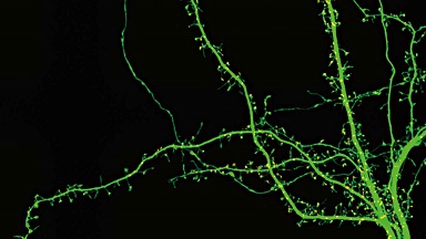 尼康生物影像中心超分辨激光掃描共聚焦顯微鏡上機培訓通知