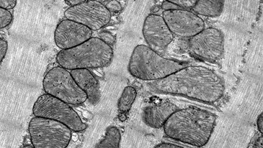 細胞生物學平臺電鏡機組組織樣品透射電鏡取材、固定及送樣注意事項培訓通知