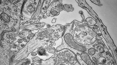 細胞生物學平臺電鏡機組細胞透射電鏡樣品制備培訓通知