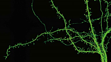 尼康生物影像中心超分辨激光掃描共聚焦顯微鏡上機培訓通知
