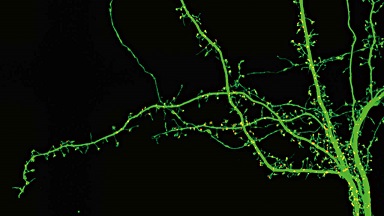 尼康生物影像中心超分辨激光掃描共聚焦顯微鏡上機培訓通知