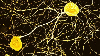 尼康生物影像中心AX R超分辨激光掃描共聚焦顯微鏡線上培訓通知