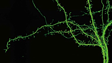 尼康生物影像中心超分辨激光掃描共聚焦顯微鏡上機培訓通知