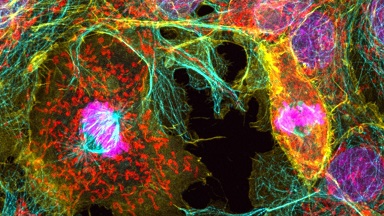 細胞影像平臺Zeiss LSM980 Airyscan2快速超分辨激光共聚焦顯微成像Workshop（一）通知