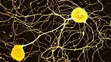 尼康生物影像中心超分辨AX R激光共聚焦顯微鏡上機培訓通知