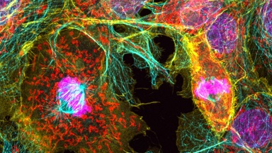 細胞影像平臺Zeiss LSM980 Airyscan2快速超分辨激光共聚焦顯微成像Workshop（二）通知