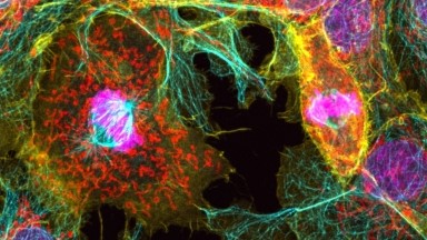 細胞影像平臺Zeiss LSM980 Airyscan2快速超分辨激光共聚焦顯微成像Workshop（三）通知