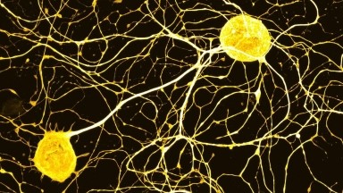 尼康生物影像中心超分辨AX R激光共聚焦顯微鏡上機培訓通知