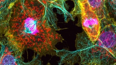 細胞影像平臺Zeiss LSM980 Airyscan2 快速超分辨激光共聚焦顯微鏡上機培訓通知