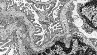 細胞生物學平臺電鏡機組透射電子顯微鏡在生醫藥研究領域中的應用培訓通知
