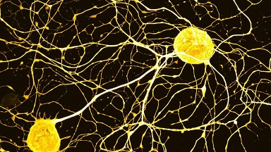 尼康生物影像中心超分辨AX R激光共聚焦顯微鏡高級應用線上培訓通知