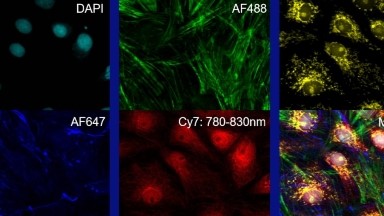 細胞生物學平臺光學成像技術線上專題系列講座（四）通知