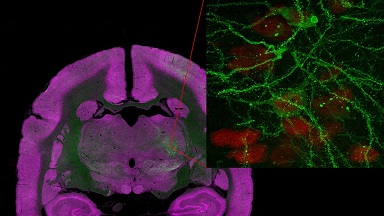 細胞影像平臺Nikon A1R HD25高分辨激光掃描共聚焦顯微鏡培訓通知