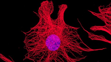 細胞影像平臺轉盤共聚焦顯微鏡上機培訓通知