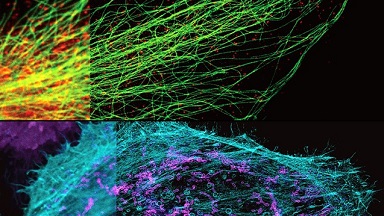 共享儀器平臺超分辨顯微鏡STEDYCON專題報告及上機試用通知