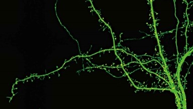 尼康生物影像中心超分辨激光掃描共聚焦顯微鏡上機培訓通知
