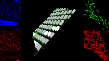 細胞生物學平臺Leica SP8激光共聚焦顯微鏡上機培訓通知