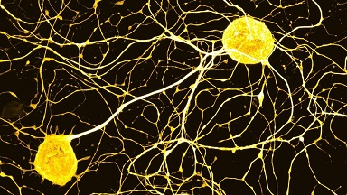 尼康生物影像中心超分辨AX R激光共聚焦顯微鏡上機培訓通知